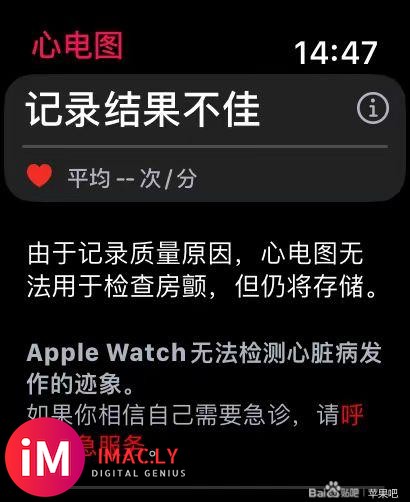 请教贴 watchOS10.1.1  ECG心电图  记录结果不佳 什么问题-1.jpg