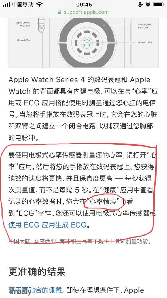 实测国行ECG硬件模块还是有用的-2.jpg