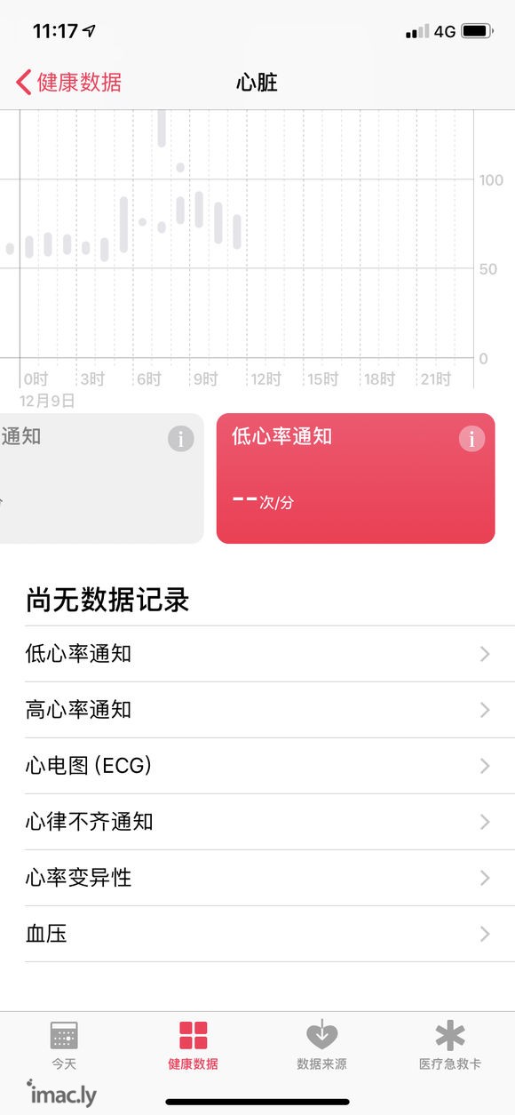 实测国行ECG硬件模块还是有用的-1.jpg