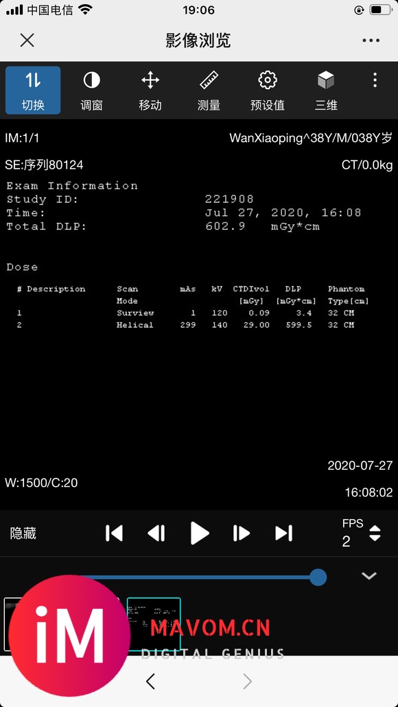 请教:股骨颈置换手术该注意些什么?-6.jpg