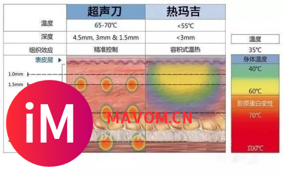 45岁适合做热玛吉还是超声刀？超声刀跟热玛吉区别大不大？揪心-16.jpg