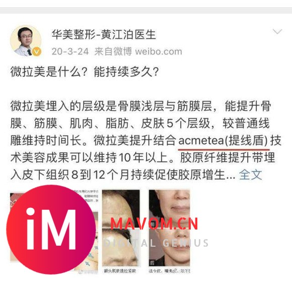 微拉美的危害和副作用、微拉美做完2月后脸都变形了-12.jpg